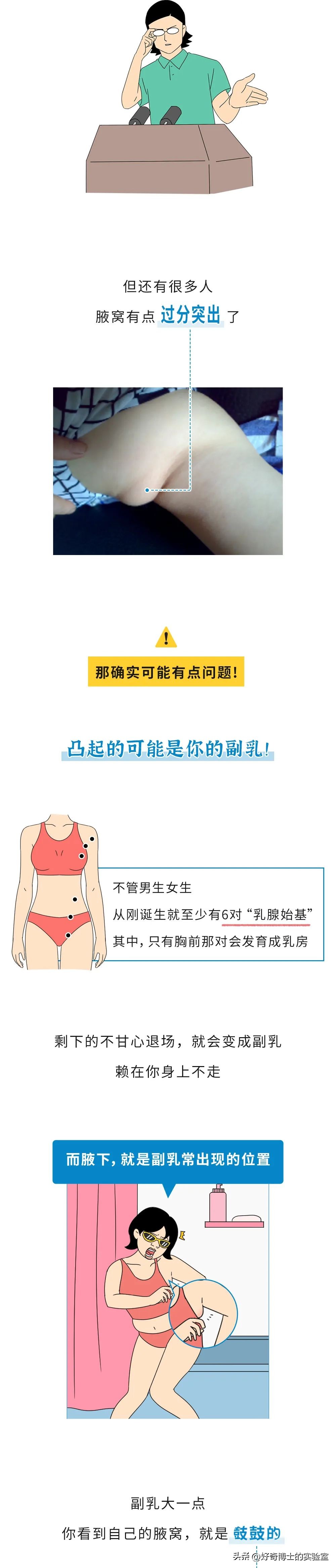 为什么有的人腋窝深,每个人腋窝下都有大凸起吗