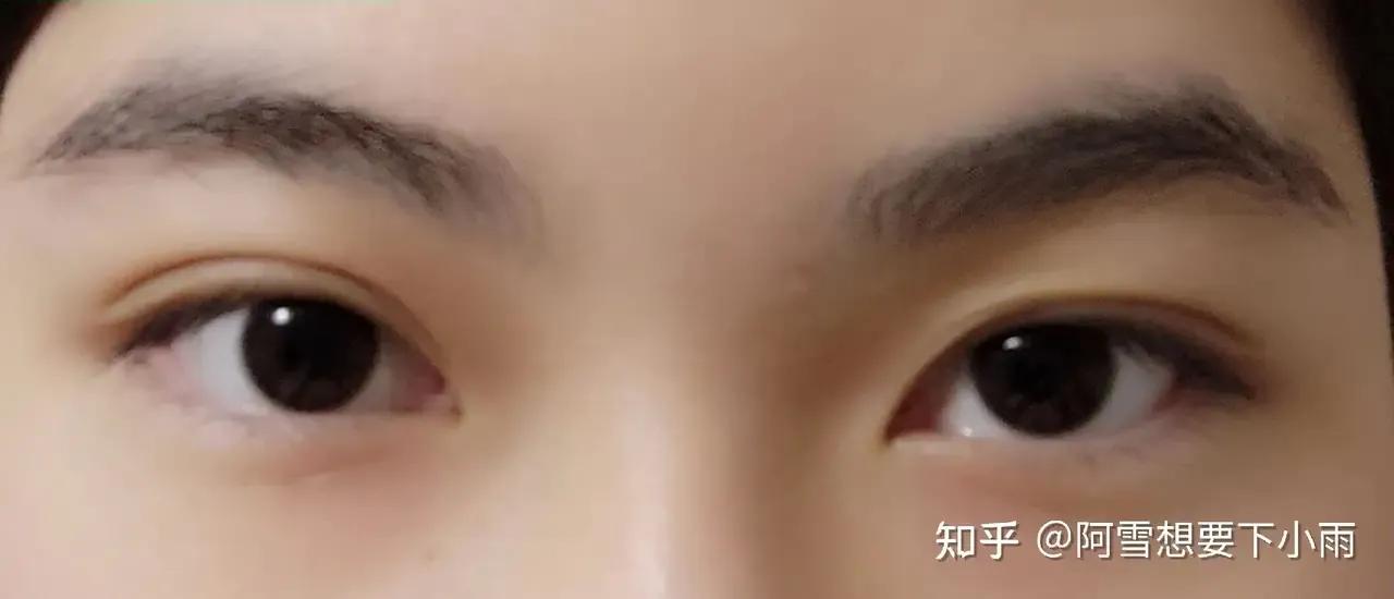 眼睛是否看出一个人的健康状态,如何通过眼睛辨别健康