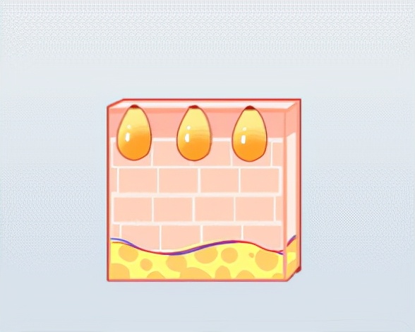 痘痘肌的十大内调方法,痘痘肌要怎么内调