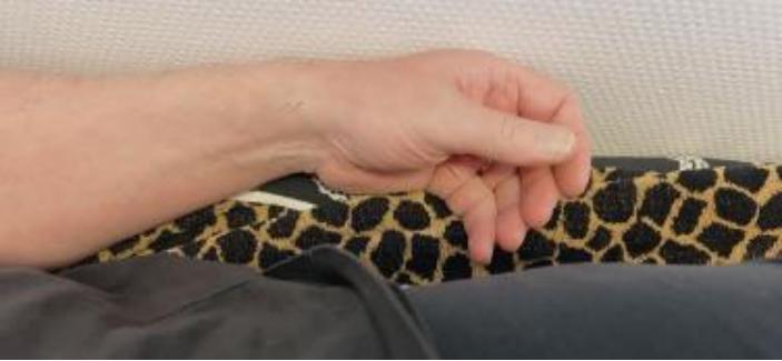 古派针灸,黄贵生针灸视频全集