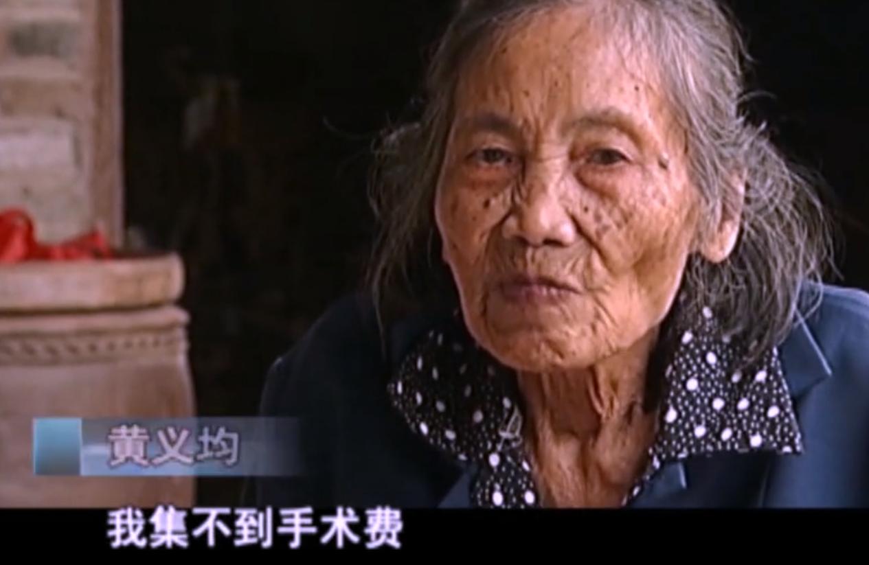2007年四川90岁老妇，腹中怀子60年未生，后检查发现胎儿没有腐烂