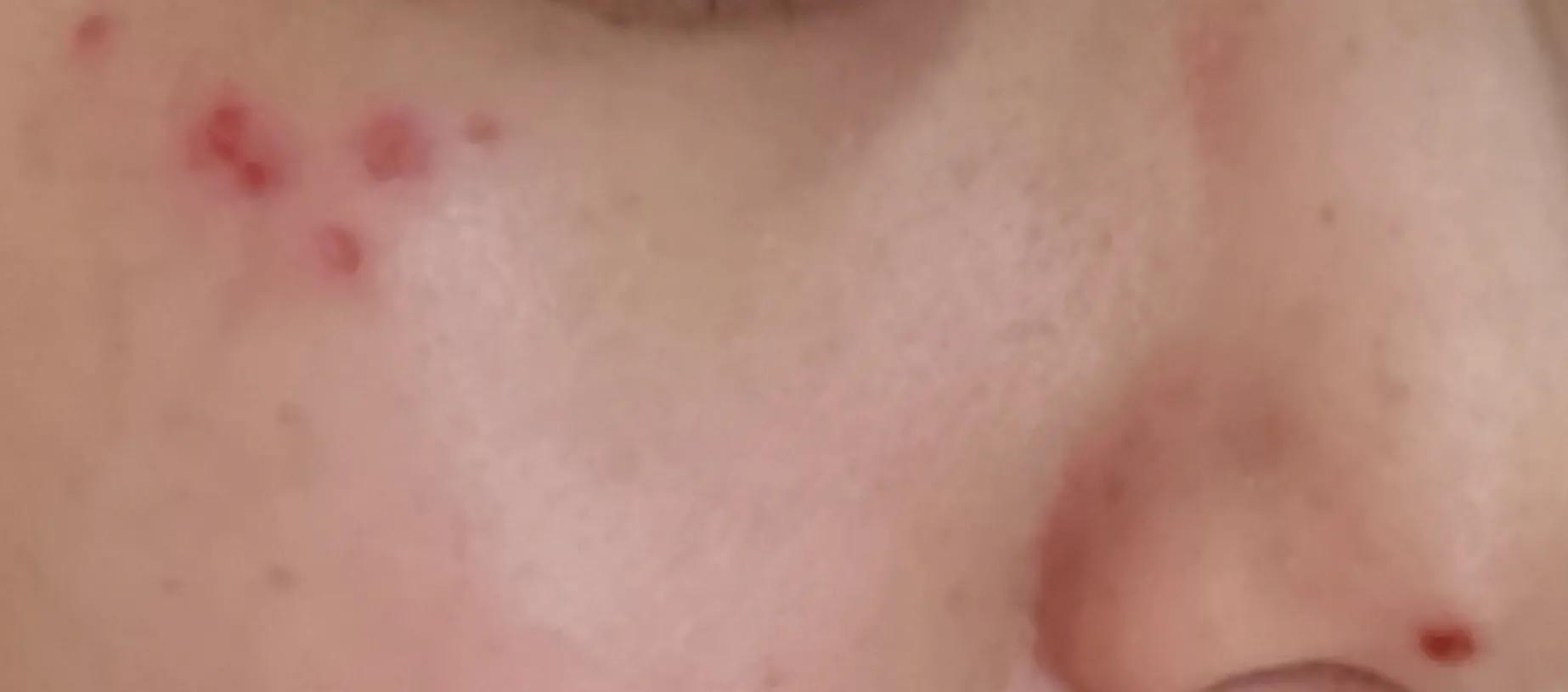 去医院美容科看皮肤靠谱吗,毁容美容