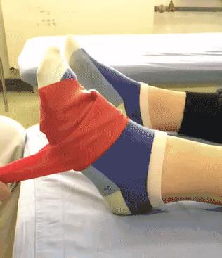 脚踝足内翻可以恢复吗,后天足内翻走路姿势