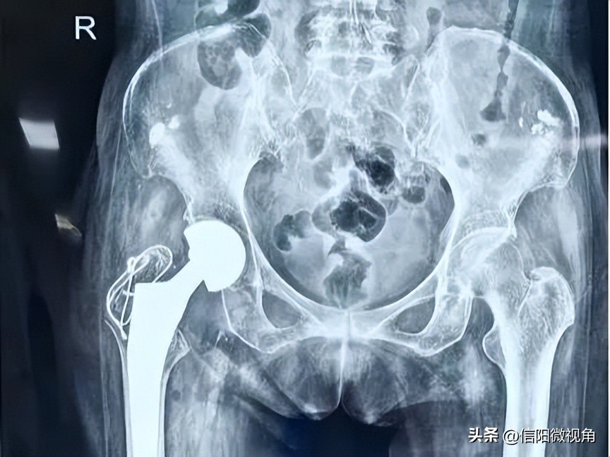 六旬老人被送医救治急寻亲属,六旬老人在信阳被送医治疗