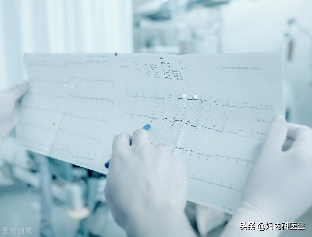 10种常见的心电图,常见心电图异常诊疗