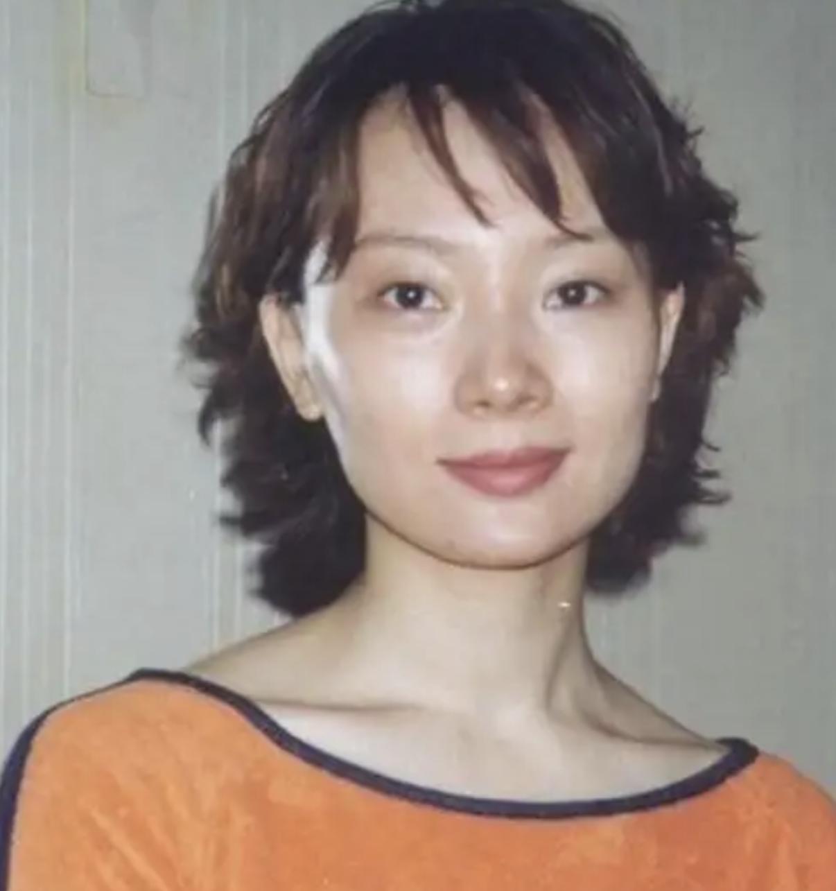 哪些明星整容后遗症越来越严重,整容明星后遗症对比图片