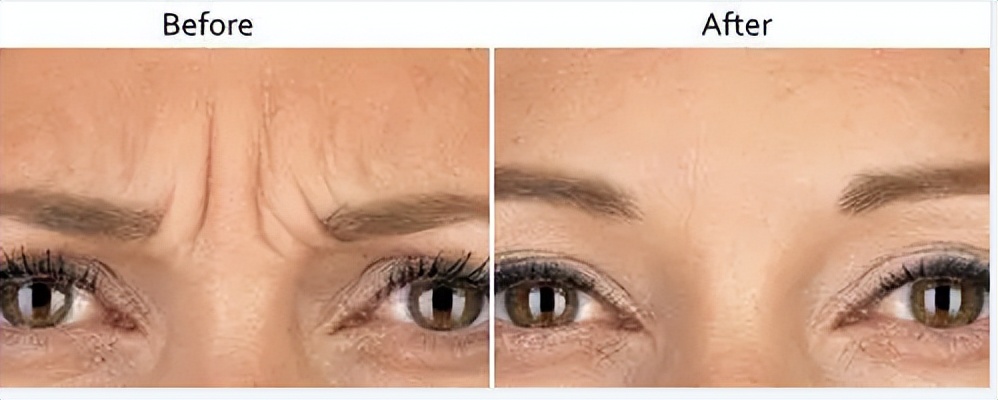 美短川字纹和英短川字纹的区别,左手川字纹和右手川字纹会怎样