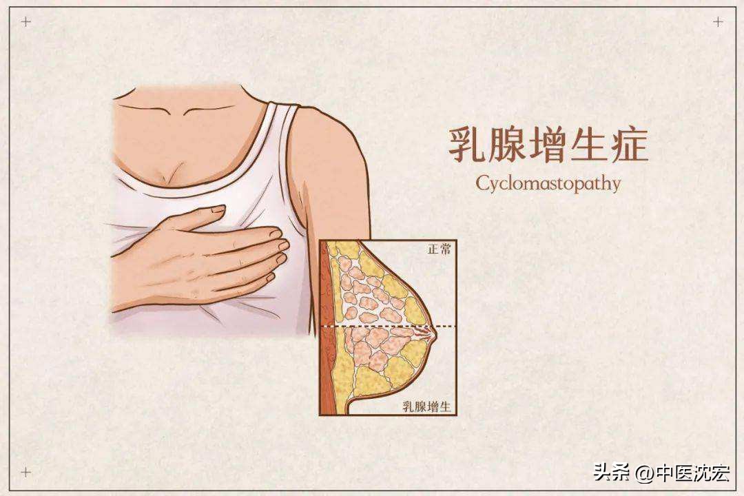 中医界的万能方逍遥丸,一代名方逍遥丸