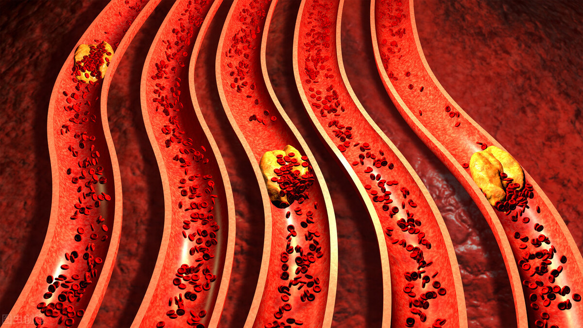 越鞠丸能治脾胃瘀堵症状,祛湿化痰越鞠丸