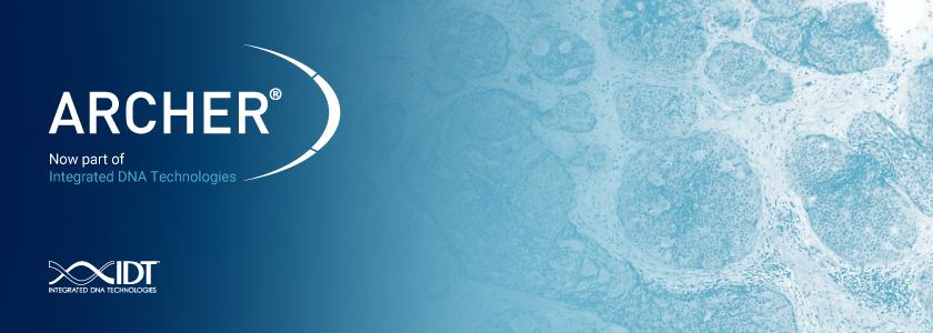 idt公司被收购,idg最新收购消息