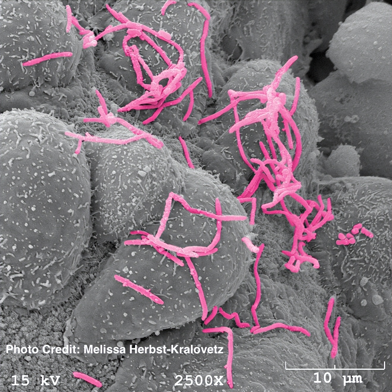 阴道菌群的时代来了！一文了解最新动态