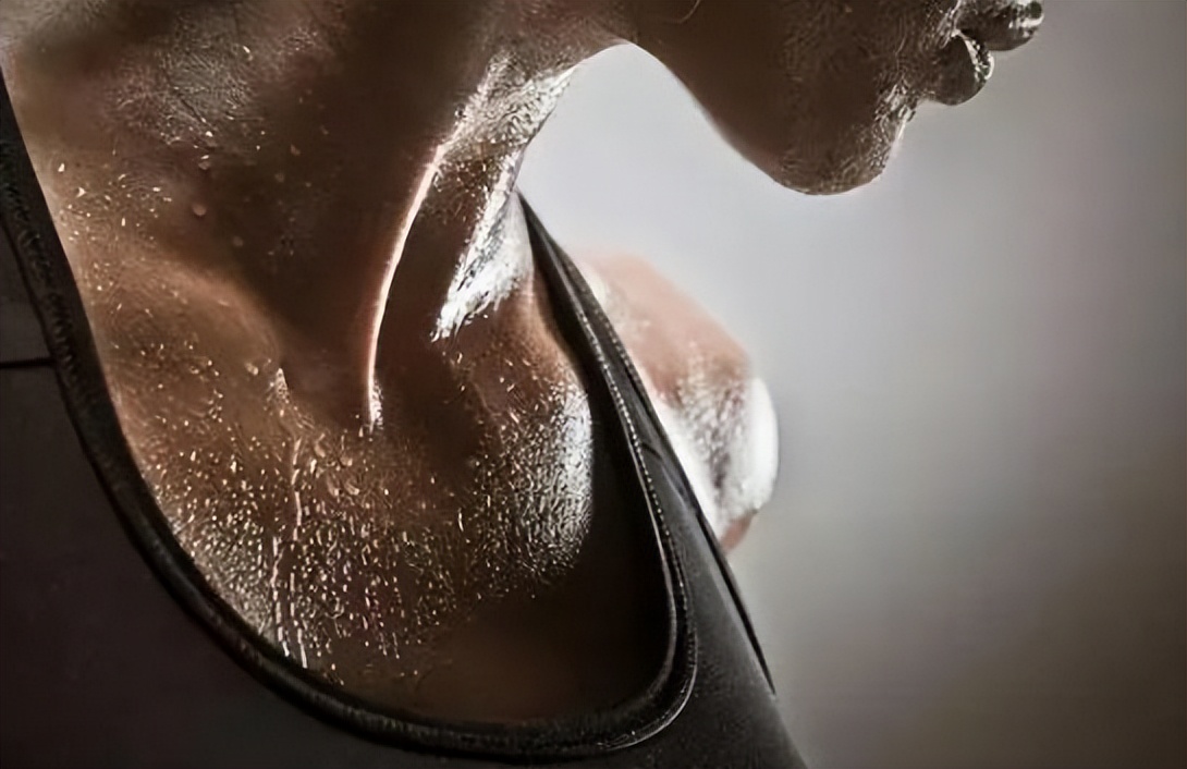 出汗和自汗多是什么原因,自汗严重且一动就出汗是什么原因