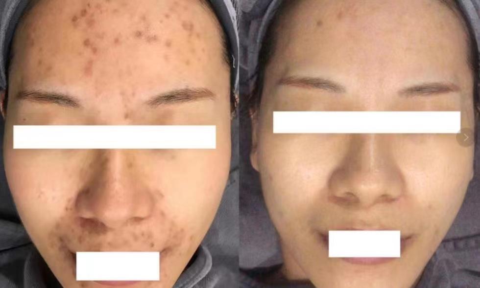 睡前怎样保养皮肤干燥缺水小视频,皮肤缺水过敏泛红发痒小妙招