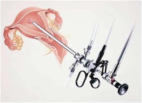 你知道宫腔镜是治疗什么的吗,宫腔镜是治疗什么的