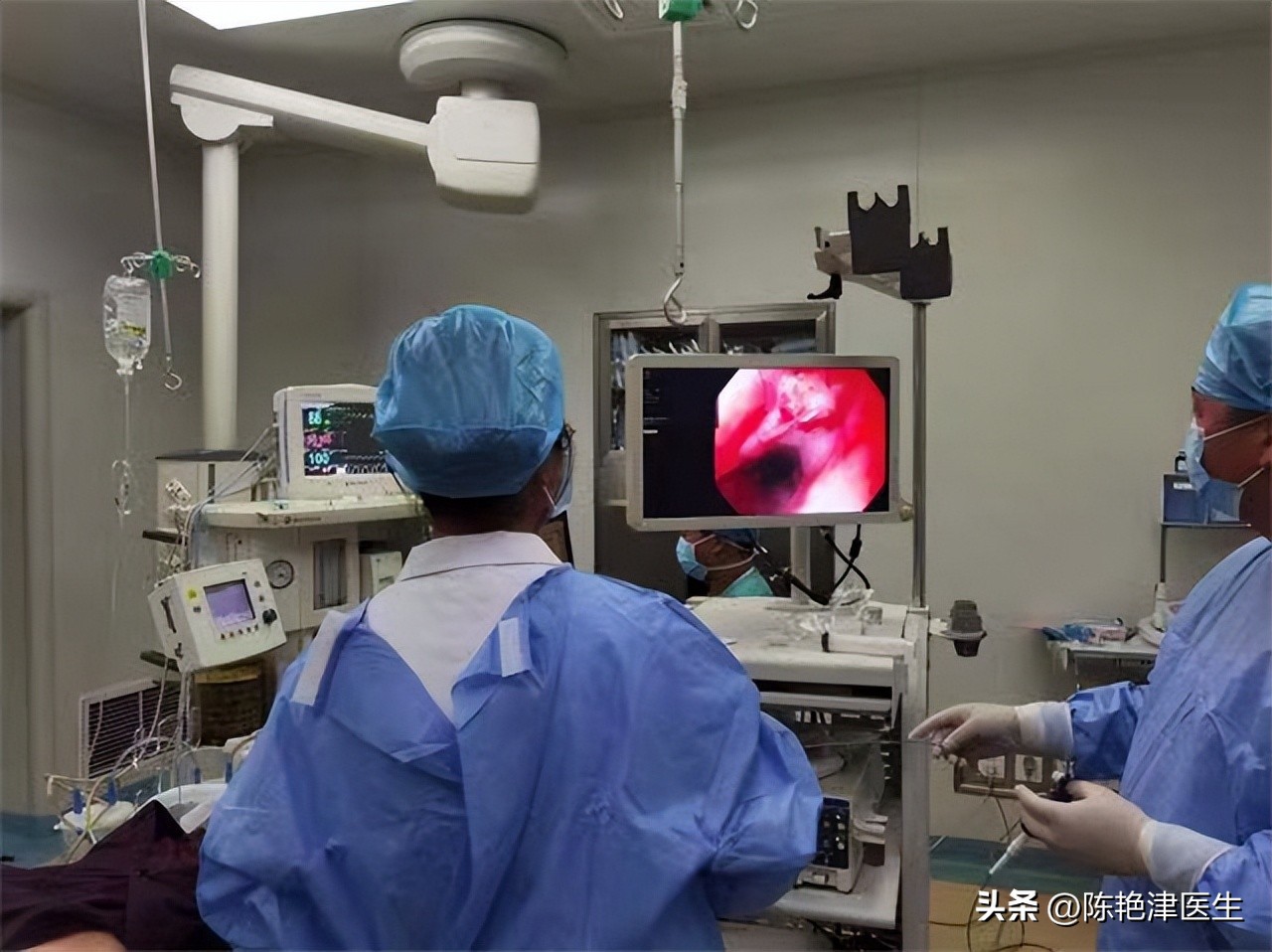 咽炎查出食管癌,以为是慢性咽炎却是食管癌