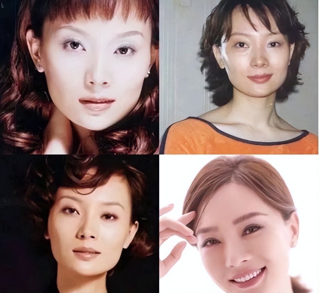 割双眼皮像变了个人,割了双眼皮像变了个人