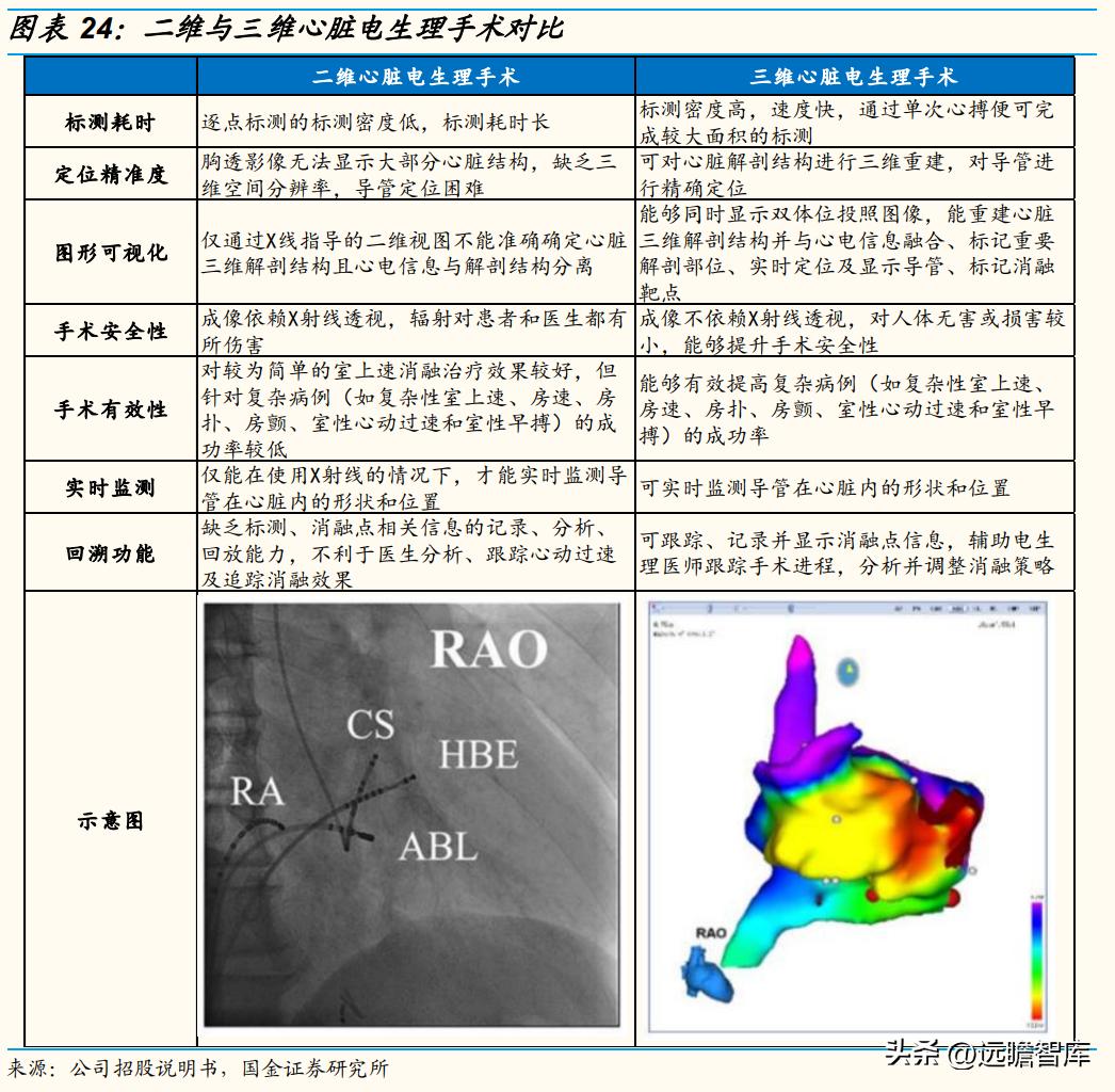 专注电生理介入诊疗，微电生理：市场高速成长，国产替代空间巨大