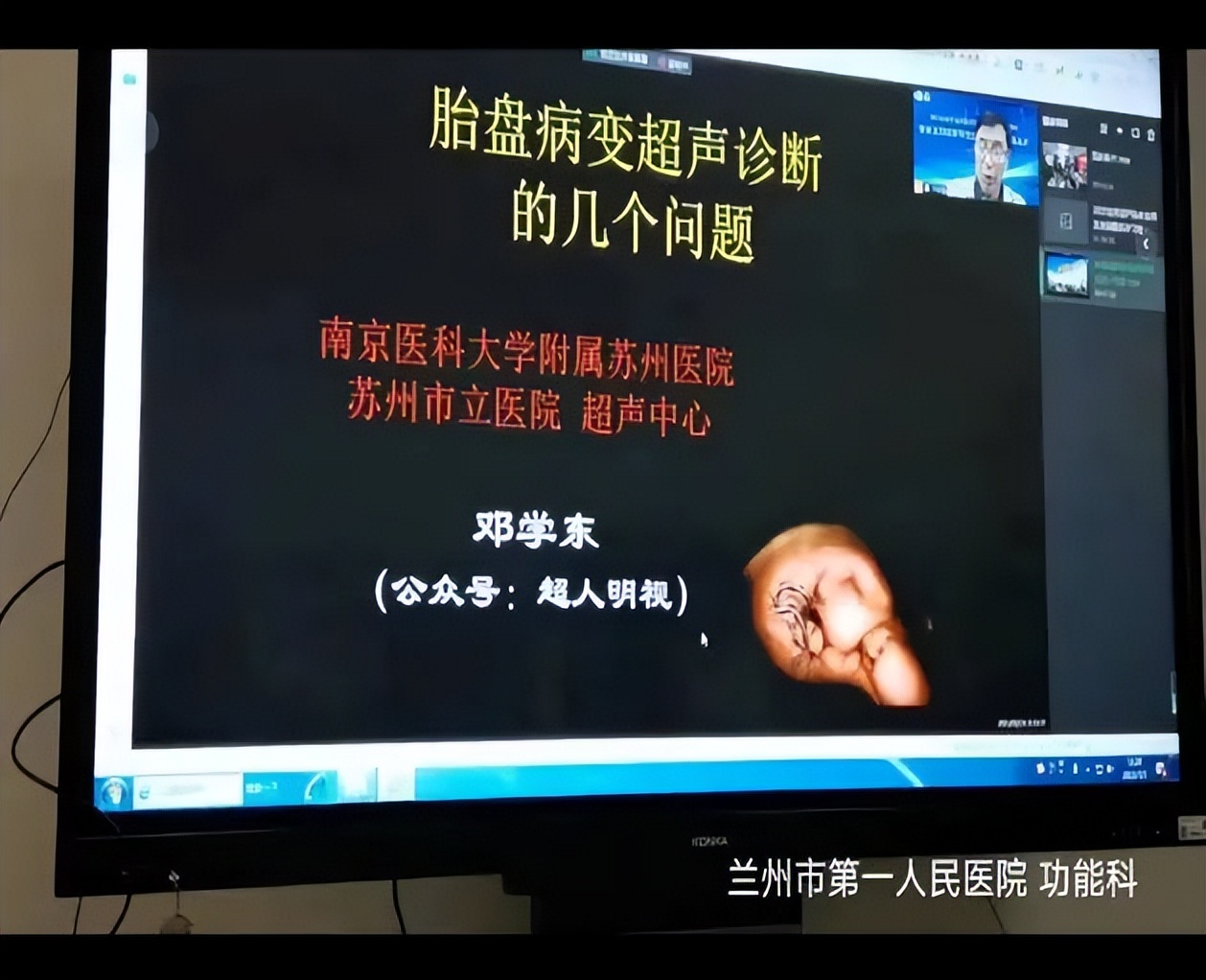 盆底功能超声,盆底超声临床应用