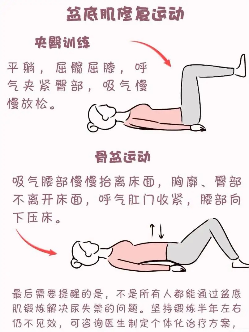 产后漏尿多长时间可以锻炼修复,产后漏尿怎么修复才好