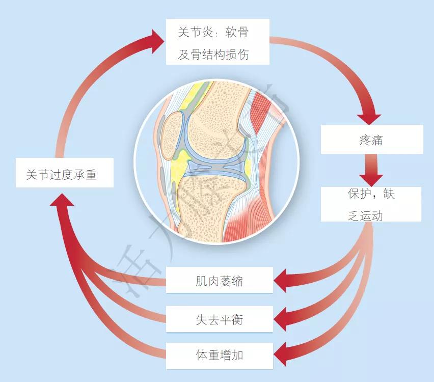 骨关节炎是如何产生的,骨关节炎的形成机制