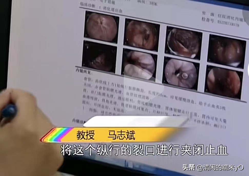 男子一口闷冰镇红茶后狂吐,男子喝冰红茶狂吐1000