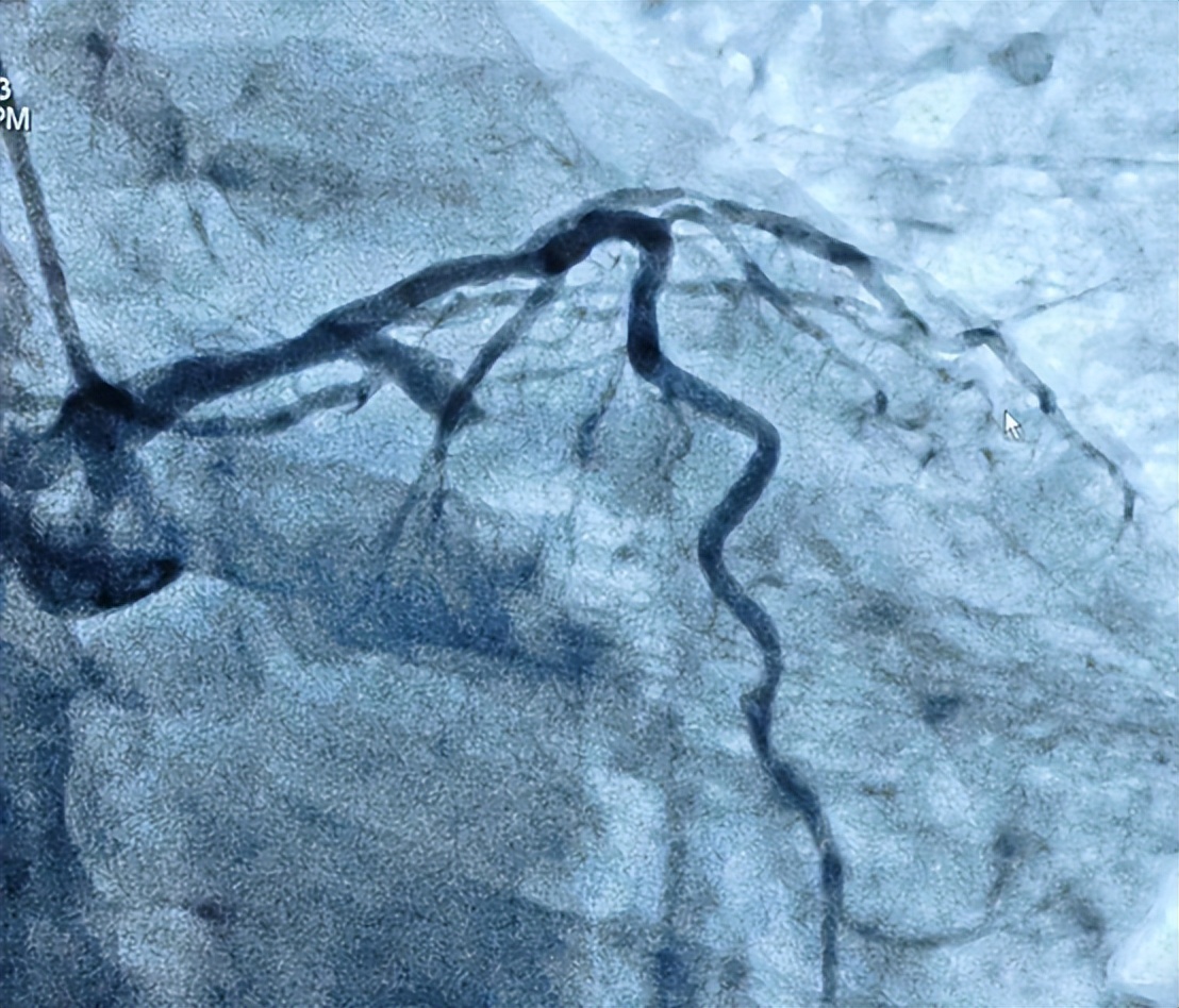 如何成为心内科医生,心内科医生养成记