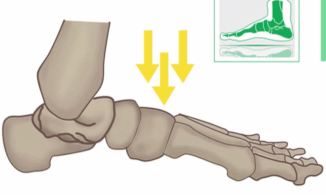 鞋子磨脚怎么办教你如何轻松解决,鞋子太紧磨脚