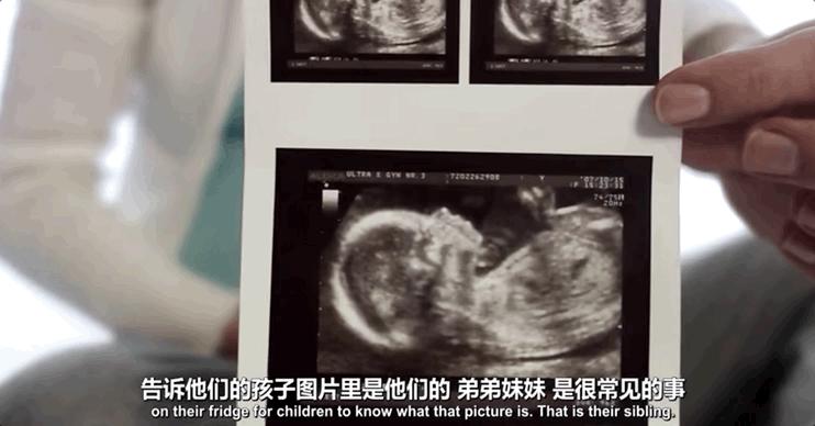 在一个无法自由堕胎的国家，女性将面对什么？