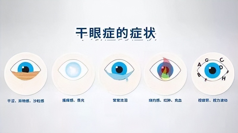儿童干眼症危害大吗,严重的干眼症会睑板腺萎缩吗