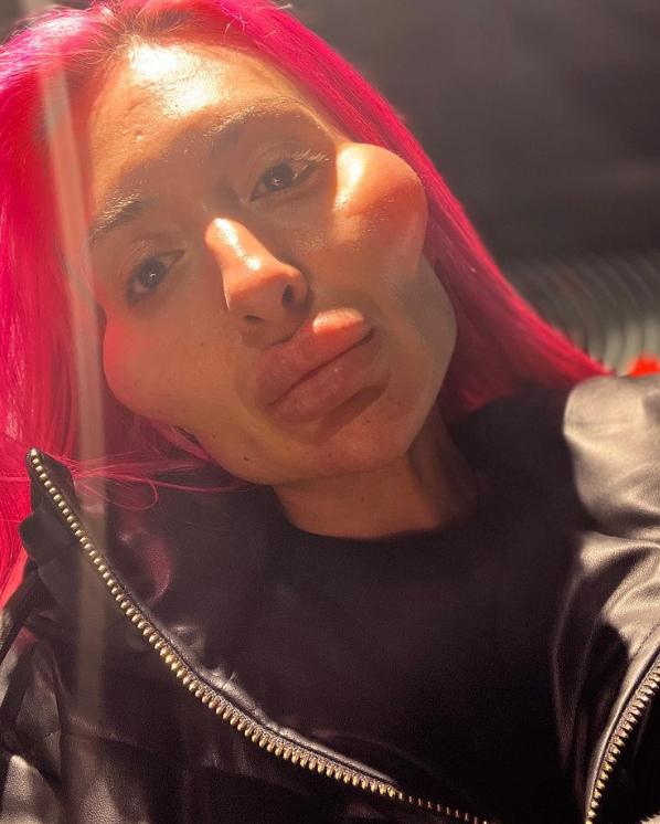 这个动手术打造世界最高颧骨的女人，再次向自己的颧骨下手了