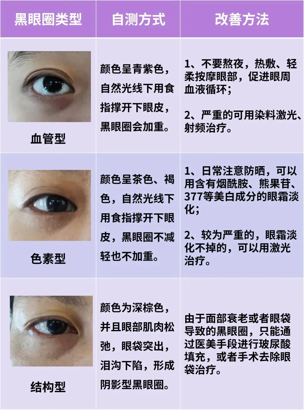 有眼袋黑眼圈用什么药膏能去除,淡化黑眼圈祛斑推荐产品