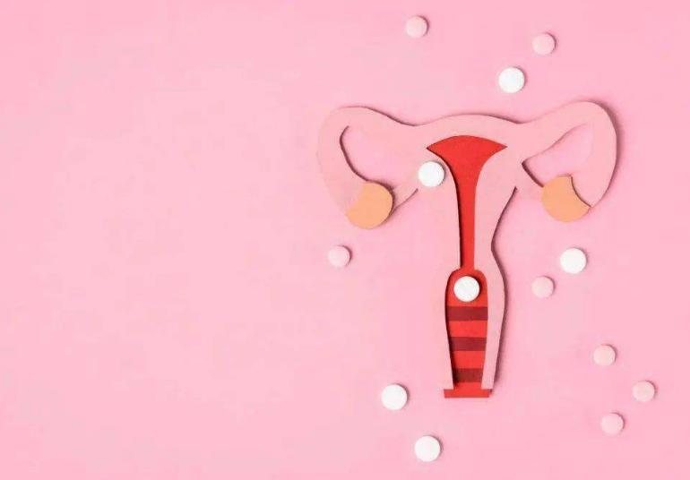 女生体检妇科有什么要注意的吗,女生体检要不要检查妇科