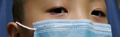 眼视光技术只是学配眼镜吗,眼视光学配眼镜