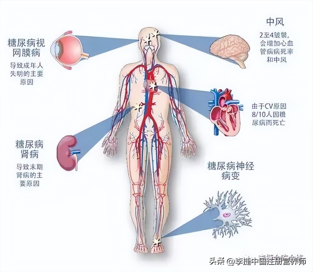 慢性肾脏病膳食营养目标,肾脏病防治饮食调理