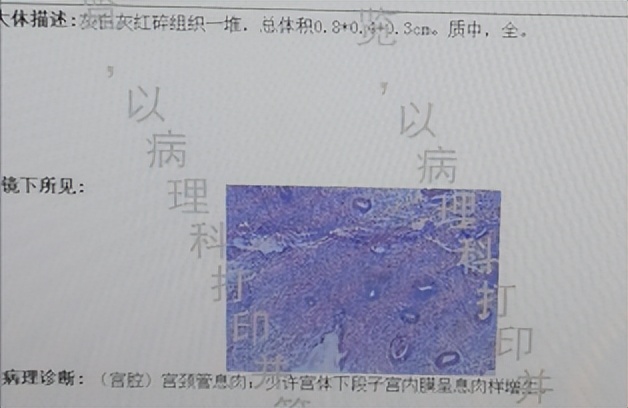子宫内膜息肉竟然导致不孕，看看24岁的年轻女性是如何治疗的？