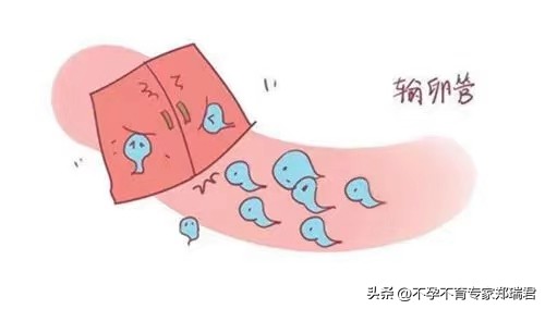 输卵管堵塞只能做试管吗？有没有别的办法？