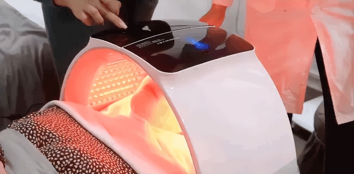 鼻子黑头感觉脏脏的,草莓黑头怎么去除最有效