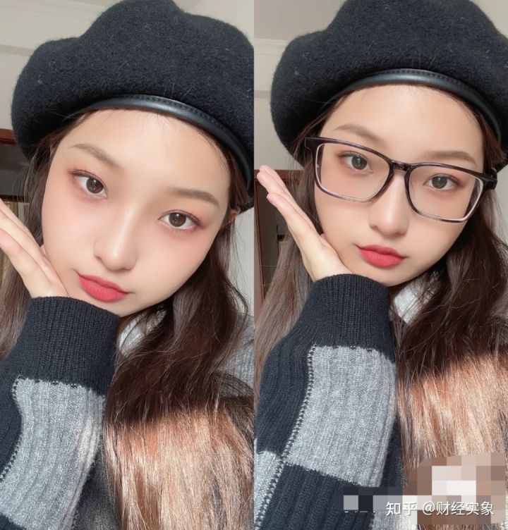 两眼间距改善最佳方法,两眼间距宽的人怎么治疗