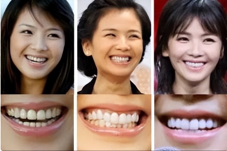 44岁刘涛变得越来越年轻了,43岁刘涛容颜耐看