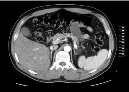 高血压药吃了是不是终身服药了,一般高血脂高血压需要终身服药么