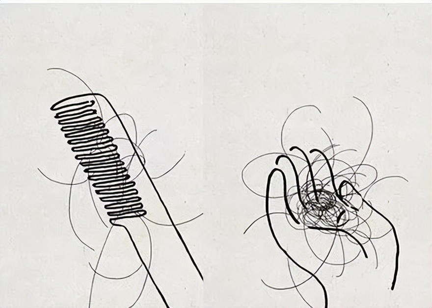 失眠头发掉得厉害是什么原因,秋天头发掉得厉害是什么原因