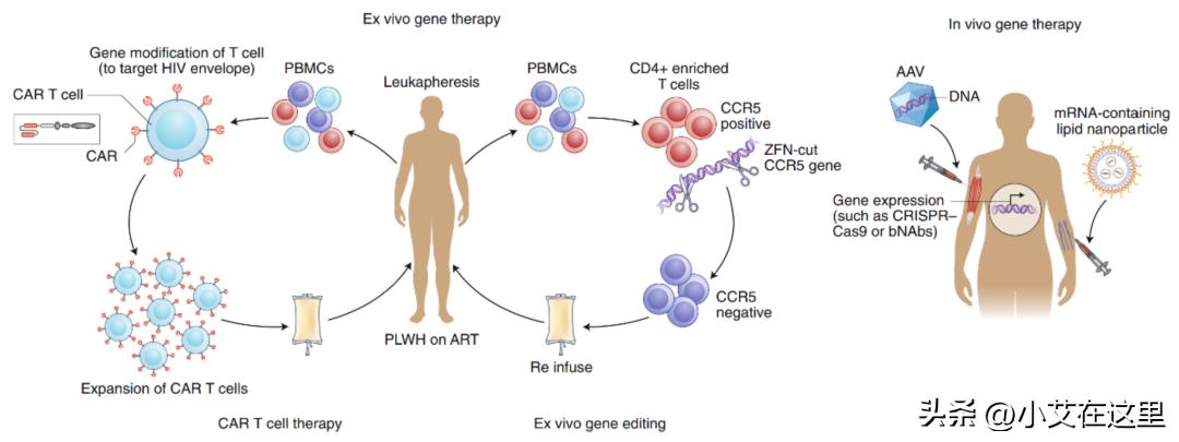 美国治疗艾滋病最新研究进展,未来5年艾滋病的治疗方法