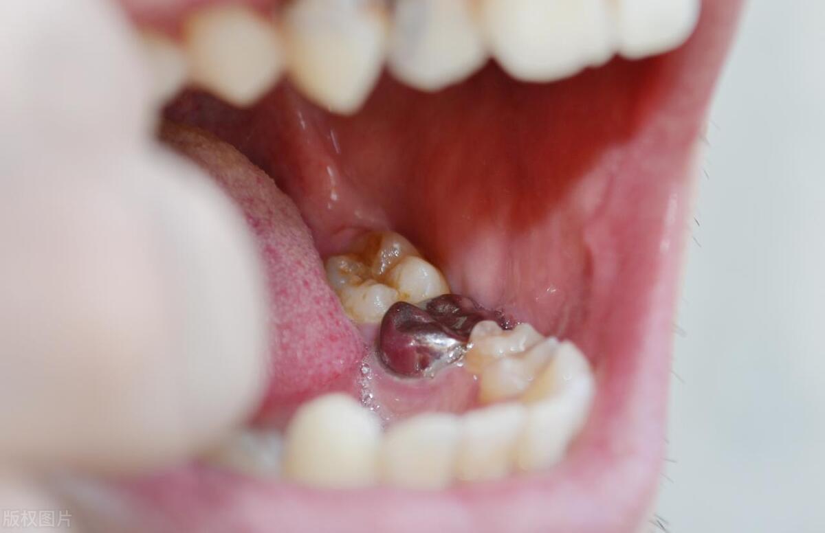 男女经常亲吻会有什么副作用吗,男女之间亲吻有什么危害