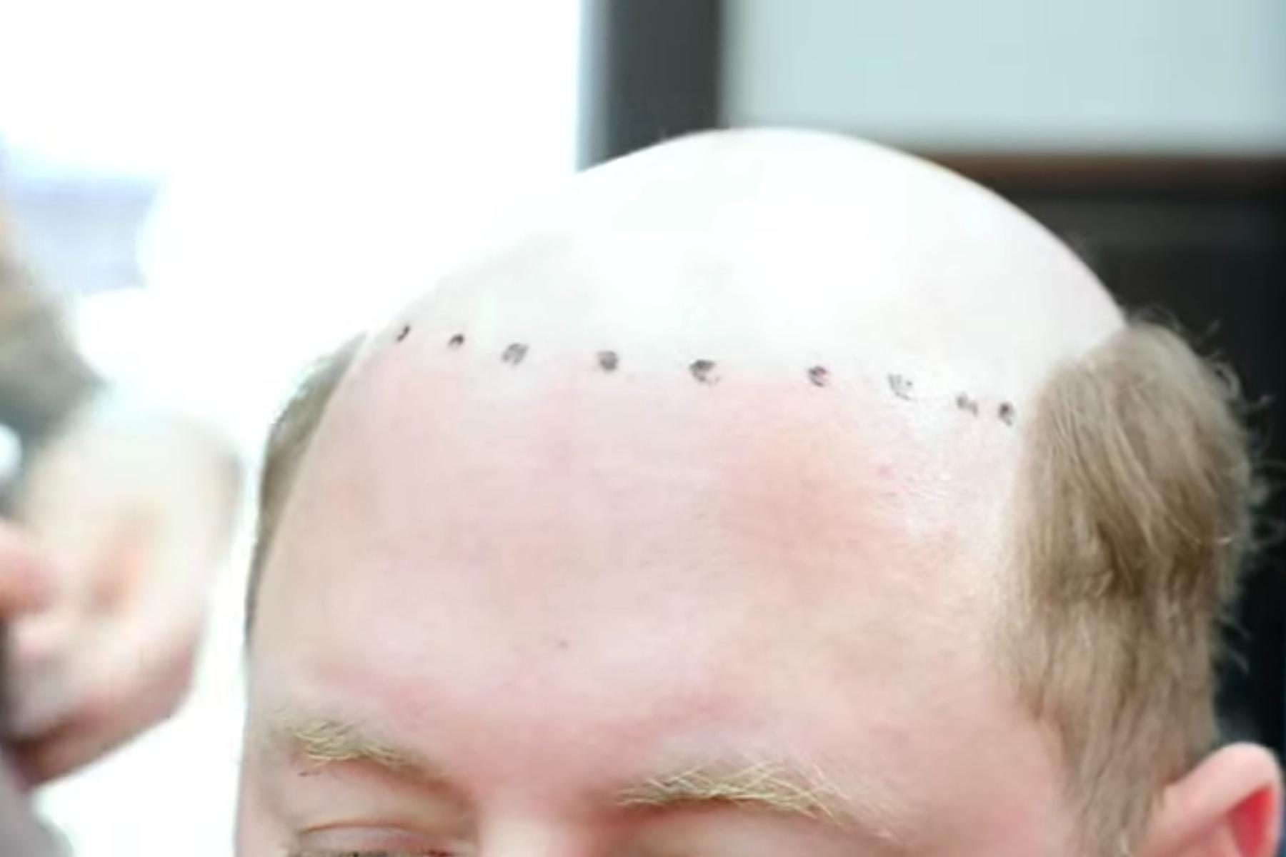 戴假发用的胶怎么清洗,假发上的粘胶怎么清理