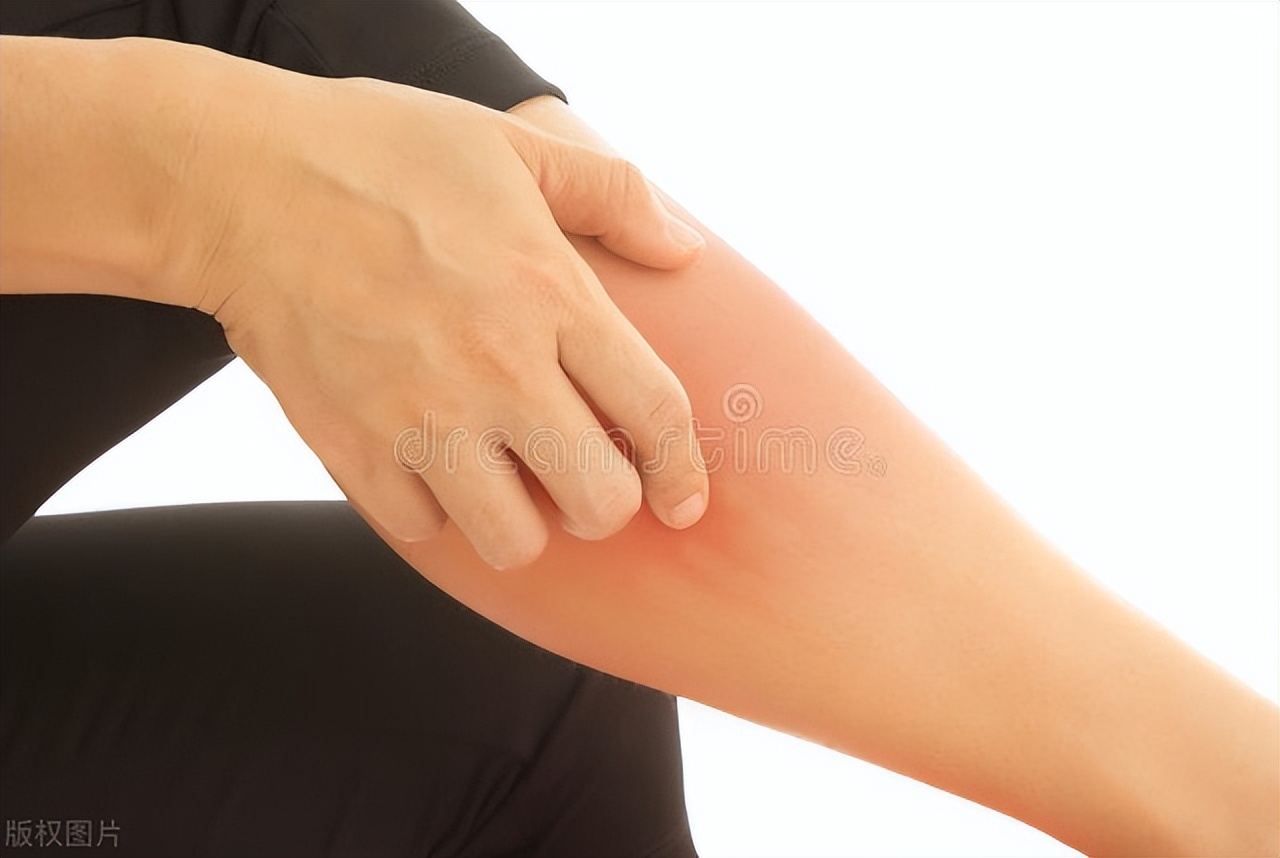 瘙痒怎么判断是湿疹还是癣,身体瘙痒都有可能哪里出现问题了