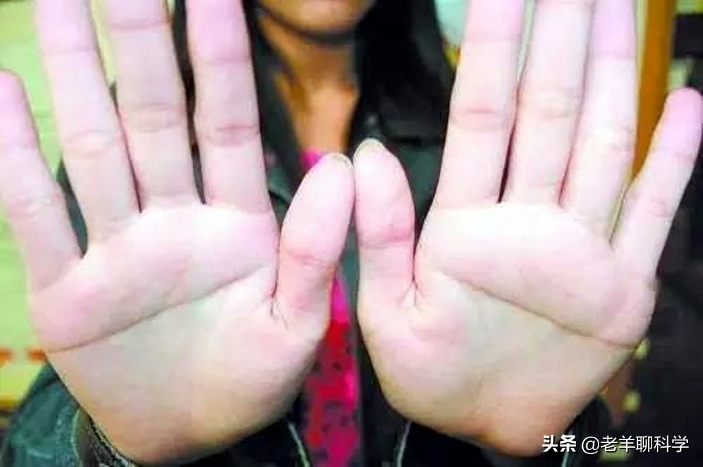断掌纹有科学依据吗,男子一只手纹断掌好吗