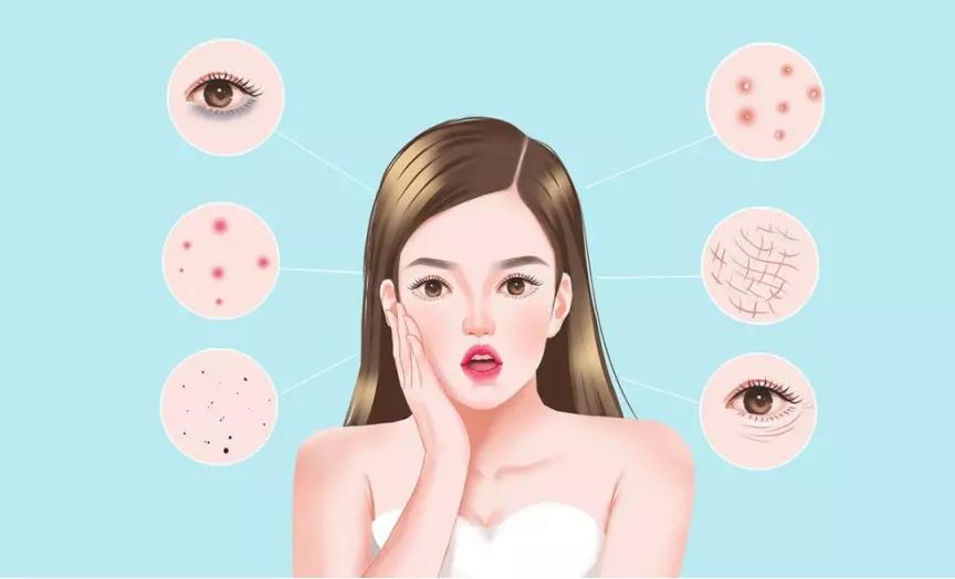 超q激光和皮秒激光,调q激光和点阵激光恢复期