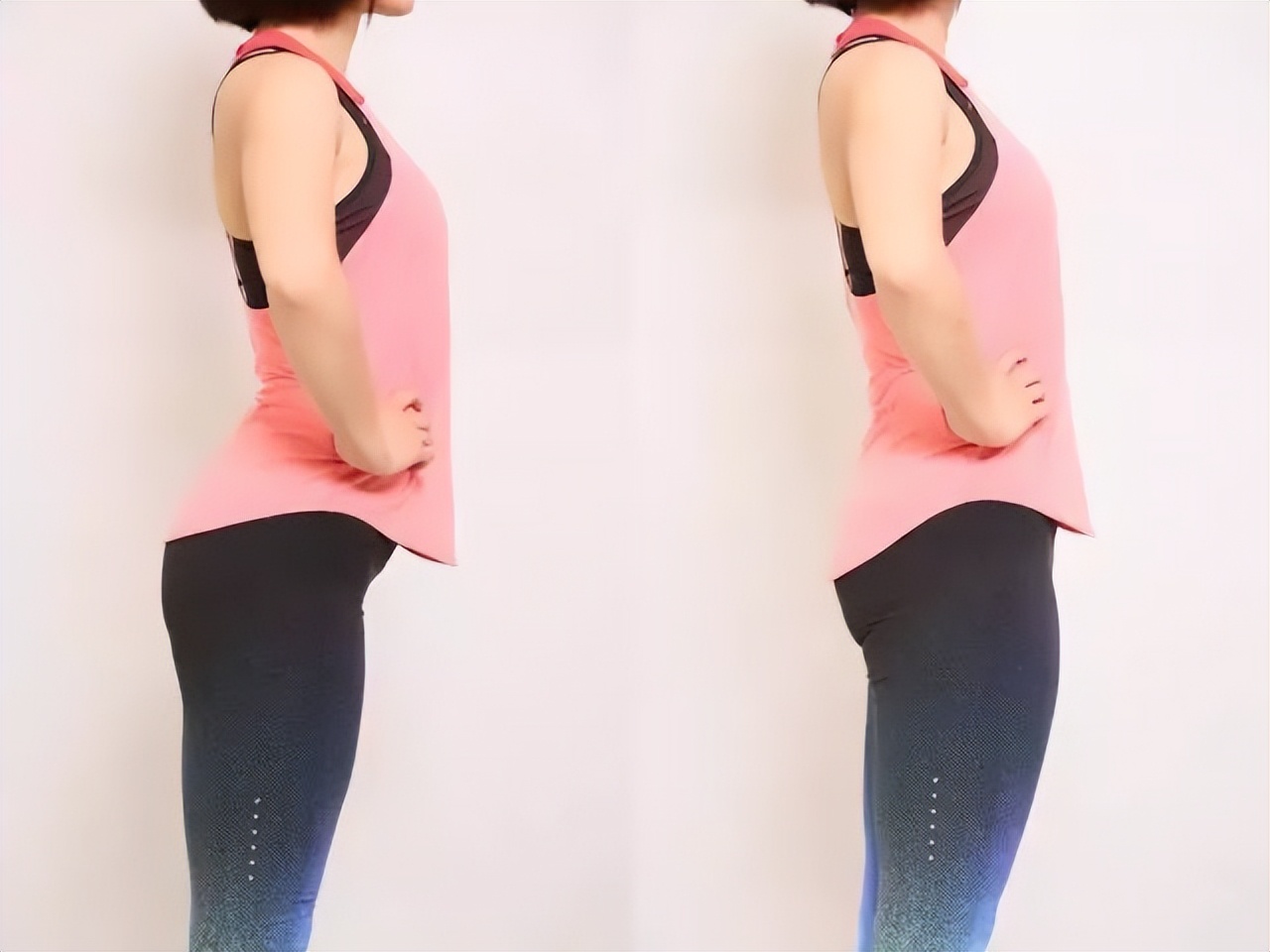 屁股太翘是什么病,屁股翘的病