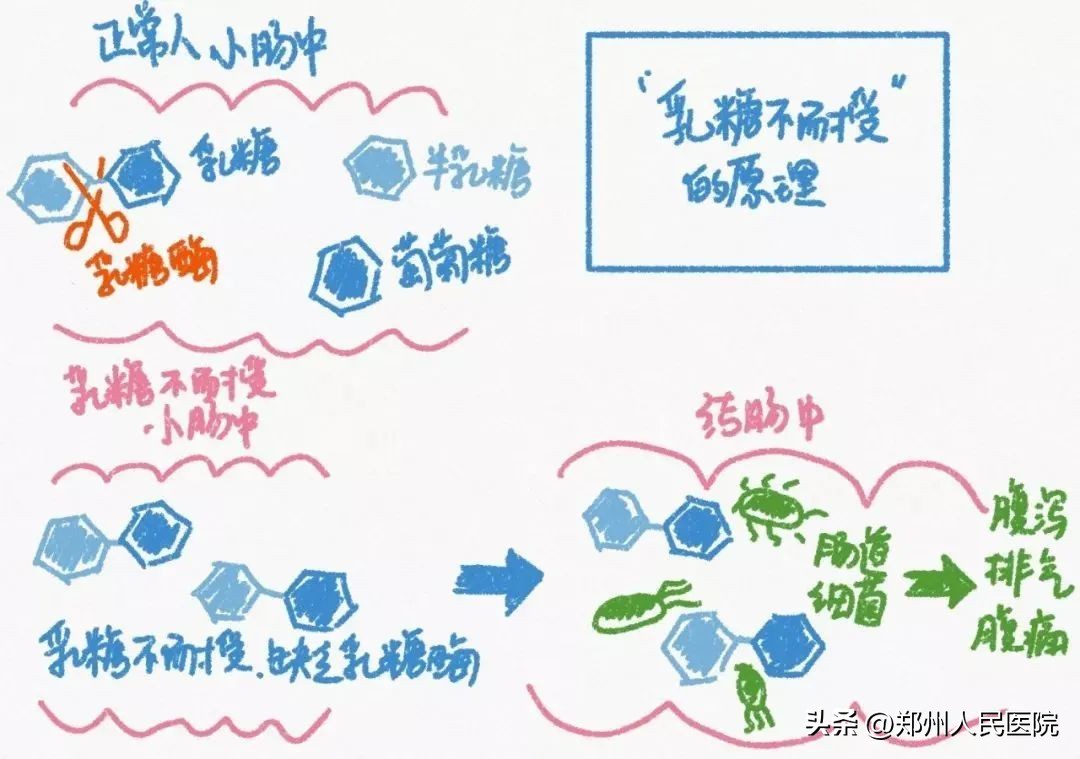 一喝牛奶就拉肚子吃什么药,巴氏消毒的牛奶一喝就拉肚子