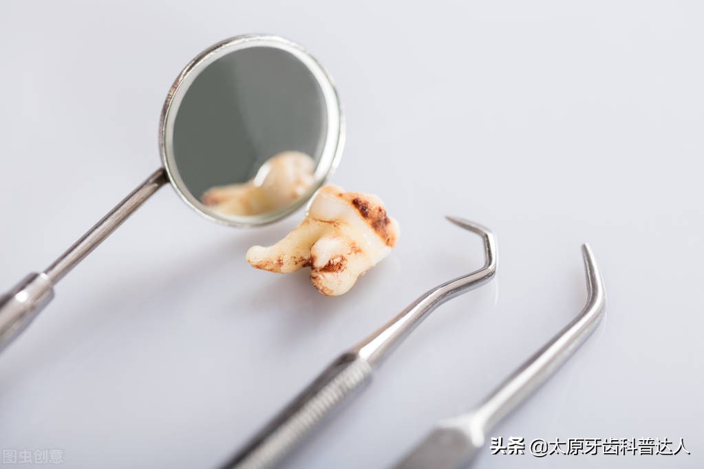 牙根没蛀牙齿蛀要拔吗,智齿旁边的牙齿蛀了可以拔吗